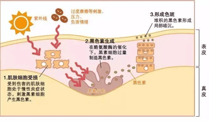 别让白癜风毁了你的夏天！济南中医白癜风医院提醒：须早防早治！
